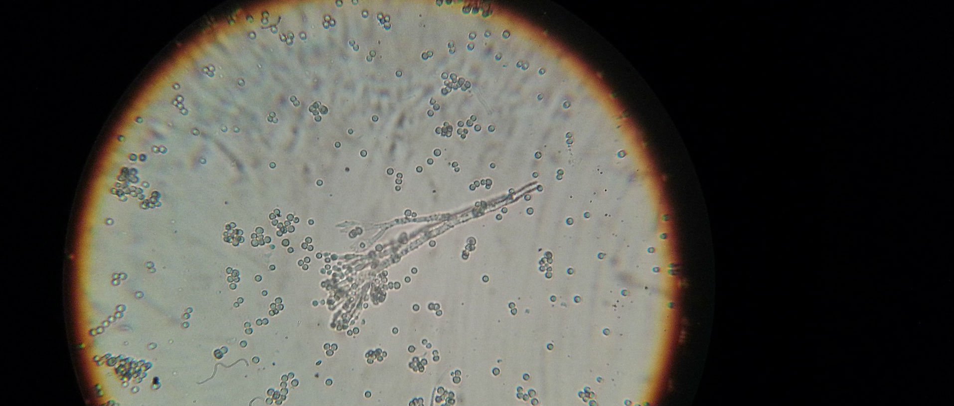 bacteria through microscope