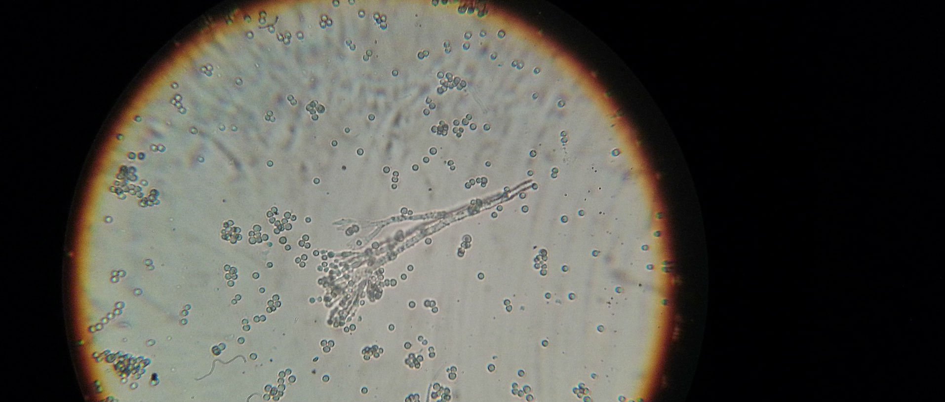 bacterii prin microscop